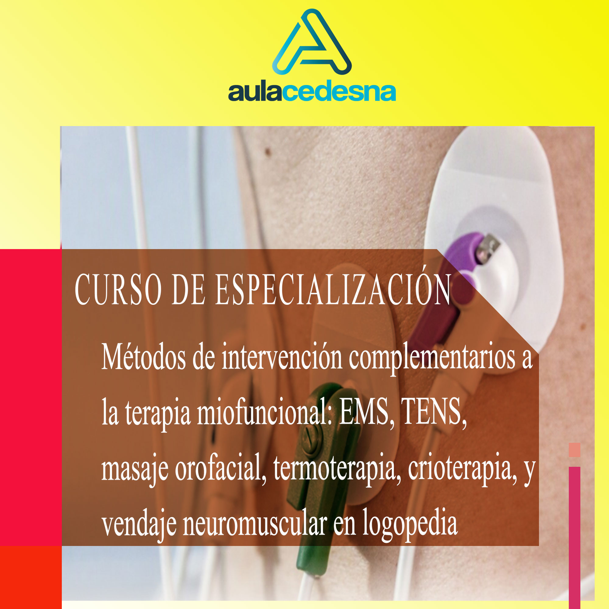 Métodos de intervención complementarios a la terapia miofuncional: EMS, TENS, masaje orofacial, termoterapia, crioterapia y vendaje neuromuscular